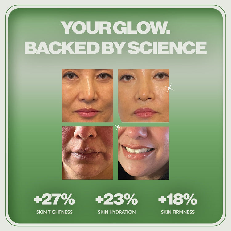 Advertisement showing before and after effects of a skincare product with scientific claims on a green background.